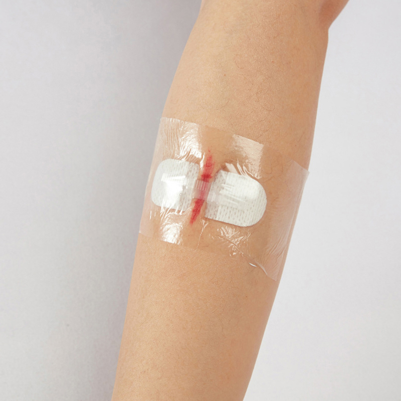 6/10Pcs 상처 폐쇄 스트립용 무료 접착 테이프 수 - Medical Tape 리뷰 및 가격